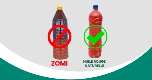 Habitudes alimentaires : l’ANAN appelle à limiter la consommation répétée de l’huile rouge « Zomi »